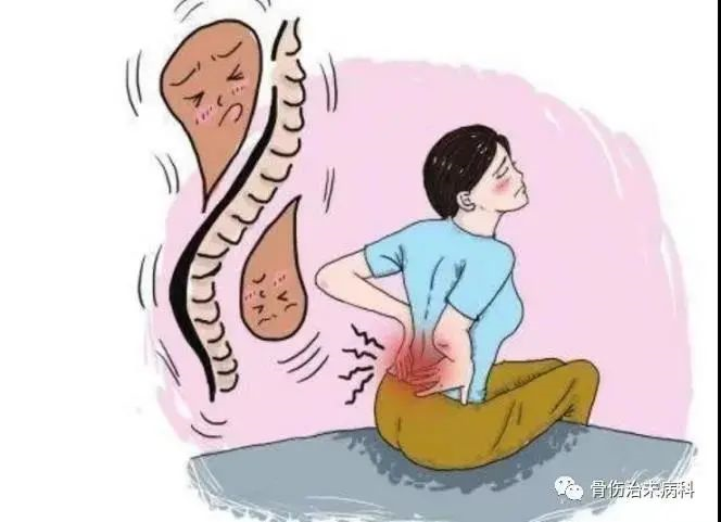 急性腰扭伤你了解吗？